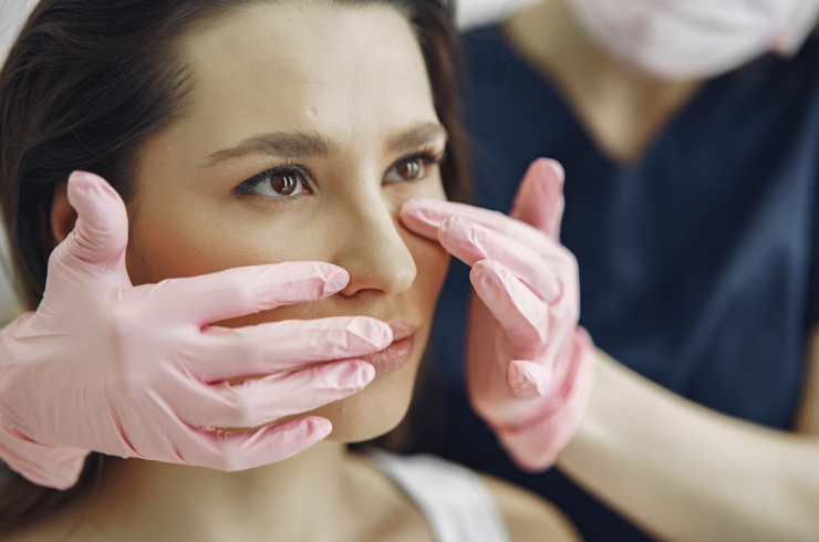 Blepharoplasty